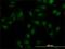 LXR beta antibody, H00007376-M04, Novus Biologicals, Immunocytochemistry image 