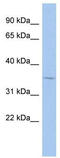 Melanoma-associated antigen 9 antibody, TA339109, Origene, Western Blot image 