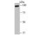 Ubiquitin carboxyl-terminal hydrolase 13 antibody, NBP2-75699, Novus Biologicals, Western Blot image 