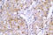 EGFR antibody, AP01890PU-N, Origene, Immunohistochemistry paraffin image 