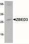 Zinc Finger BED-Type Containing 3 antibody, NBP1-76326, Novus Biologicals, Western Blot image 