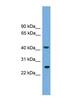 Ras-related protein Rab-35 antibody, NBP1-79483, Novus Biologicals, Western Blot image 