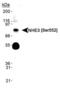 Solute Carrier Family 9 Member A3 antibody, MA1-46464, Invitrogen Antibodies, Western Blot image 