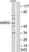 Histidyl-TRNA Synthetase antibody, TA313996, Origene, Western Blot image 