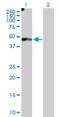 EGF Containing Fibulin Extracellular Matrix Protein 2 antibody, H00030008-D01P, Novus Biologicals, Western Blot image 