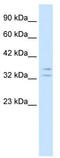 GHF1 antibody, TA329271, Origene, Western Blot image 