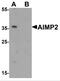 Aminoacyl tRNA synthase complex-interacting multifunctional protein 2 antibody, NBP2-81885, Novus Biologicals, Western Blot image 