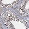Coiled-Coil Domain Containing 184 antibody, HPA039947, Atlas Antibodies, Immunohistochemistry paraffin image 