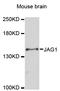 Jagged Canonical Notch Ligand 1 antibody, STJ114627, St John
