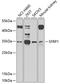 Secreted Frizzled Related Protein 1 antibody, 18-866, ProSci, Western Blot image 