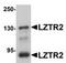 Protein transport protein Sec16B antibody, TA306930, Origene, Western Blot image 