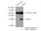 15-Hydroxyprostaglandin Dehydrogenase antibody, 11035-1-AP, Proteintech Group, Immunoprecipitation image 