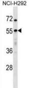 Ubiquitin Specific Peptidase 27 X-Linked antibody, abx029130, Abbexa, Western Blot image 