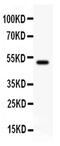 Erythrocyte Membrane Protein Band 4.1 Like 1 antibody, PA5-79206, Invitrogen Antibodies, Western Blot image 