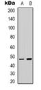 Transcription Factor Like 5 antibody, orb318964, Biorbyt, Western Blot image 