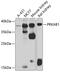 Protein Kinase AMP-Activated Non-Catalytic Subunit Beta 1 antibody, 23-280, ProSci, Western Blot image 