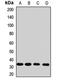 Thiosulfate Sulfurtransferase antibody, LS-C668477, Lifespan Biosciences, Western Blot image 