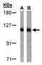 Damage Specific DNA Binding Protein 1 antibody, PA5-27113, Invitrogen Antibodies, Western Blot image 