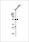 ATR Interacting Protein antibody, orb224133, Biorbyt, Western Blot image 