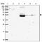 Zinc Finger Protein 513 antibody, PA5-62418, Invitrogen Antibodies, Western Blot image 