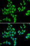 Protein BTG1 antibody, abx004860, Abbexa, Western Blot image 