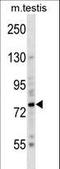 BR Serine/Threonine Kinase 2 antibody, LS-C164307, Lifespan Biosciences, Western Blot image 