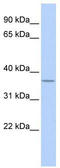 Methylenetetrahydrofolate Dehydrogenase (NADP+ Dependent) 2, Methenyltetrahydrofolate Cyclohydrolase antibody, TA339301, Origene, Western Blot image 