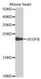 Vascular Endothelial Growth Factor B antibody, abx001744, Abbexa, Western Blot image 