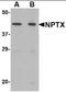 NP2 antibody, orb88377, Biorbyt, Western Blot image 