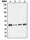 Nuclear Transcription Factor Y Subunit Gamma antibody, LS-C352586, Lifespan Biosciences, Western Blot image 