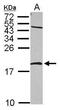 Nucleoside diphosphate kinase B antibody, GTX116091, GeneTex, Western Blot image 