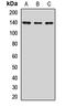 Jumonji And AT-Rich Interaction Domain Containing 2 antibody, LS-C667853, Lifespan Biosciences, Western Blot image 