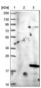 Succinate dehydrogenase assembly factor 2, mitochondrial antibody, PA5-58904, Invitrogen Antibodies, Western Blot image 