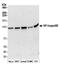 Nuclear factor NF-kappa-B p100 subunit antibody, A301-821A, Bethyl Labs, Western Blot image 