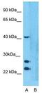 Lysocardiolipin Acyltransferase 1 antibody, GTX46729, GeneTex, Western Blot image 