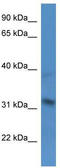 SH3 Domain Binding Protein 5 antibody, TA342929, Origene, Western Blot image 
