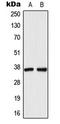Aldo-keto reductase family 1 member C1 antibody, LS-C353965, Lifespan Biosciences, Western Blot image 