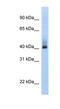 Ankyrin Repeat Domain 42 antibody, NBP1-70700, Novus Biologicals, Western Blot image 