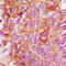 BAX antibody, LS-C351882, Lifespan Biosciences, Immunohistochemistry paraffin image 