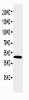 Hydroxysteroid 17-Beta Dehydrogenase 2 antibody, GTX12311, GeneTex, Western Blot image 