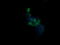UDP-GlcNAc:betaGal beta-1,3-N-acetylglucosaminyltransferase 2 antibody, LS-C174261, Lifespan Biosciences, Immunofluorescence image 