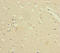 VPS33B Late Endosome And Lysosome Associated antibody, LS-C676705, Lifespan Biosciences, Immunohistochemistry paraffin image 
