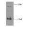 Insulin-like 3 antibody, FNab04335, FineTest, Western Blot image 