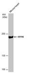 Myosin-6 antibody, MA5-27819, Invitrogen Antibodies, Western Blot image 