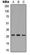 Matrix Metallopeptidase 26 antibody, orb234909, Biorbyt, Western Blot image 