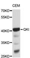 QKI, KH Domain Containing RNA Binding antibody, STJ25250, St John