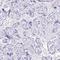 Defensin-5 antibody, HPA015775, Atlas Antibodies, Immunohistochemistry frozen image 