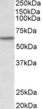 TATA-Box Binding Protein antibody, 42-998, ProSci, Enzyme Linked Immunosorbent Assay image 