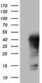 Tet Methylcytosine Dioxygenase 1 antibody, M00603-1, Boster Biological Technology, Western Blot image 