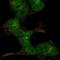 Zinc Finger CCCH-Type Containing 6 antibody, NBP2-69012, Novus Biologicals, Immunocytochemistry image 
